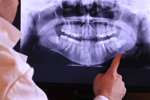 Best Emergency Orthodontic Services in Orinda, CA