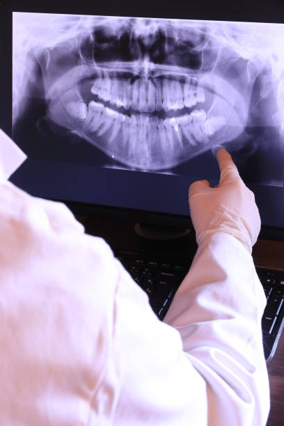 Best Emergency Wisdom Teeth Removal in Orinda, CA