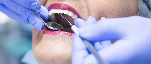 Best Emergency Gum Treatment in Orinda, CA
